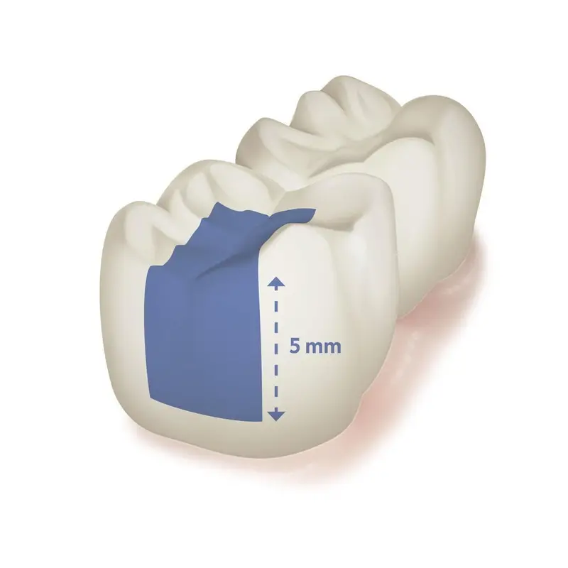 DMG Ecosite Bulk Fill Spuit Light | 2 g