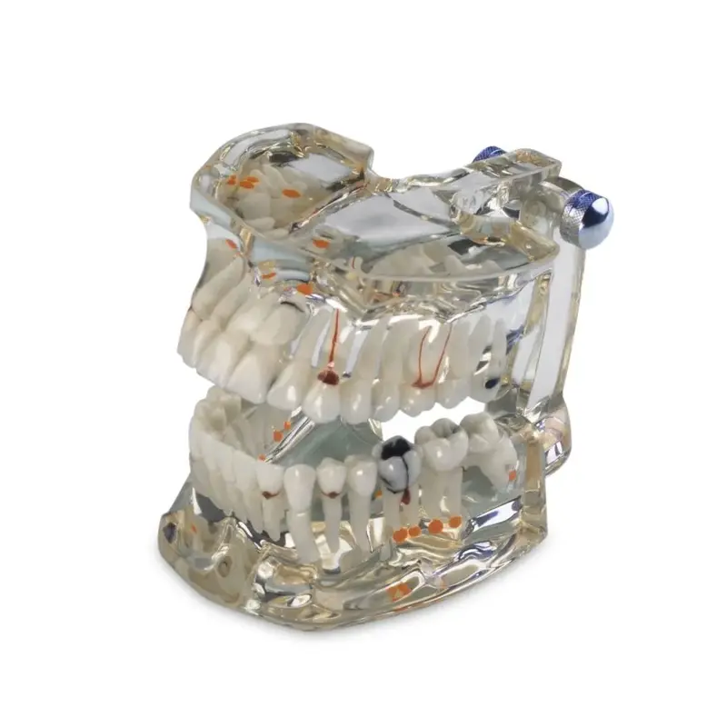Lactona Transparant gebitsmodel (Demonstratiemodel ware grootte)